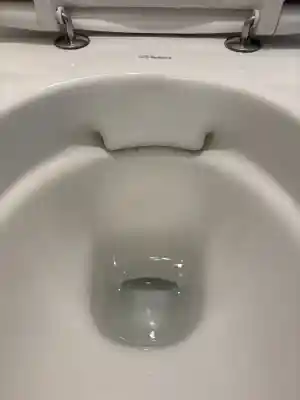 Urine steen verwijdering.jpg